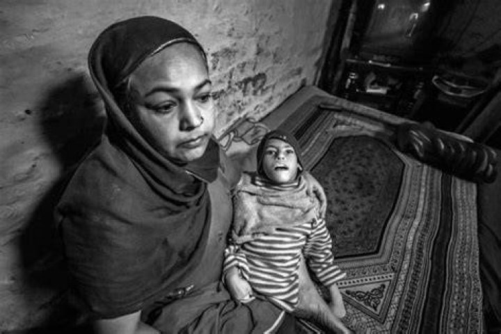 Bhopal Disaster Child