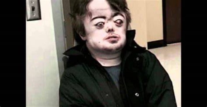 Brian Peppers story