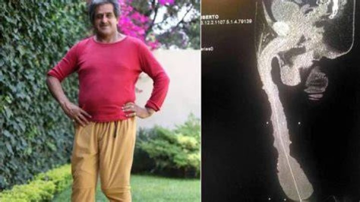 Cabrera Penis