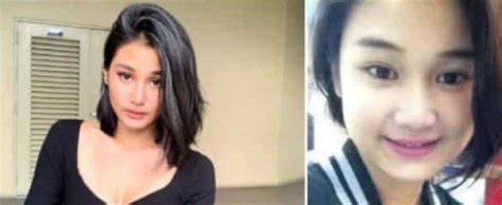 Chie Filomeno face before her surgery