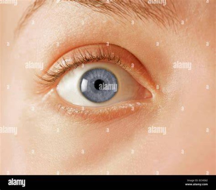 Close Up Of Open Eye