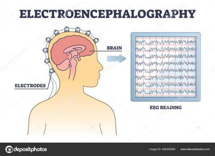 Electroencephalography Illustration