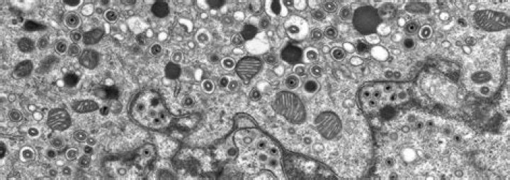 Electron Microscope Images