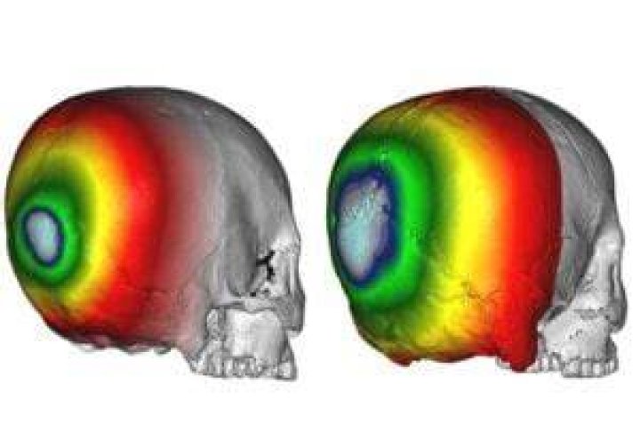 Hirota Skull Vs Yayoi Skull
