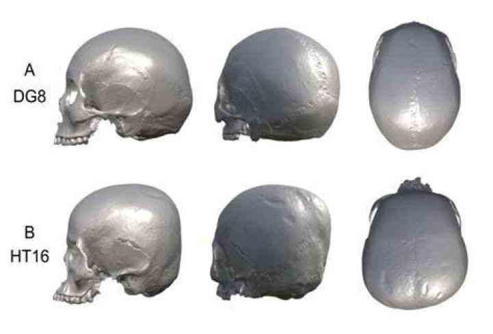 Hirota Skull