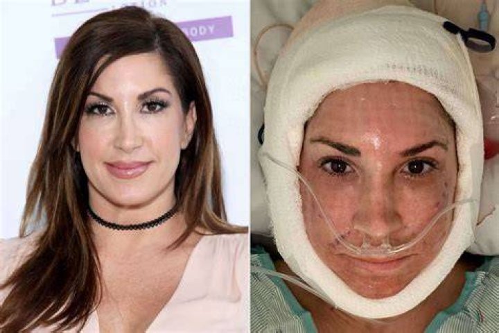 Housewives plastic surgery jaqueline laurita