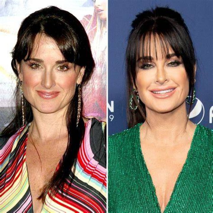 Housewives plastic surgery kyle richards