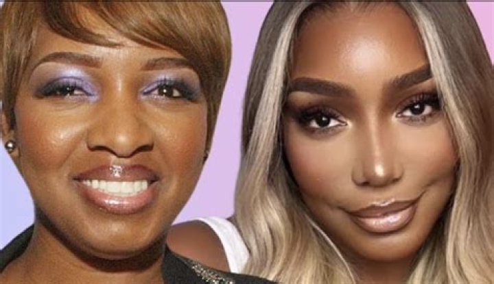 Housewives plastic surgery nene leakes
