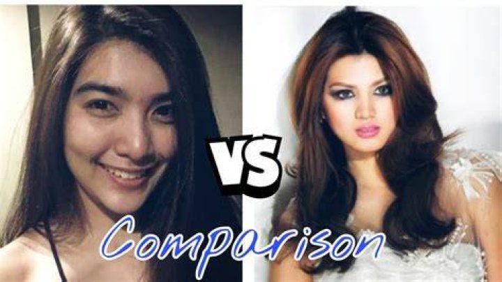 Jinky Serrano Before Surgery After Surgery Photos